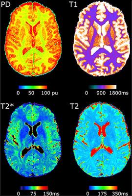 Multiparametric Quantitative MRI in Neurological Diseases